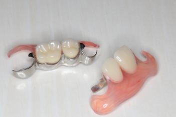 コンティースの入れ歯